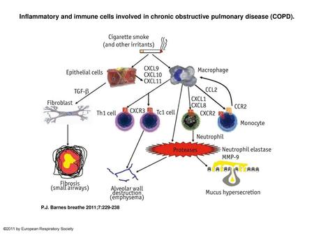 Inflammatory and immune cells involved in chronic obstructive pulmonary disease (COPD). Inflammatory and immune cells involved in chronic obstructive pulmonary.