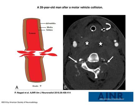 A 28-year-old man after a motor vehicle collision.