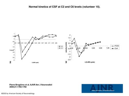 Normal kinetics of CSF at C2 and C6 levels (volunteer 15).