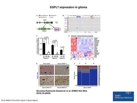 EGFL7 expression in glioma