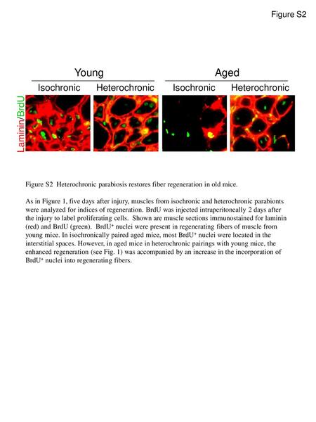 Young Aged Isochronic Heterochronic Isochronic Heterochronic