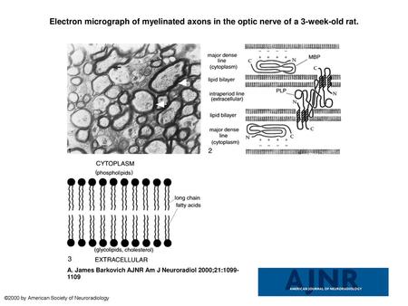 Electron micrograph of myelinated axons in the optic nerve of a 3-week-old rat. Electron micrograph of myelinated axons in the optic nerve of a 3-week-old.