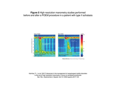 Figure 5 High-resolution manometry studies performed