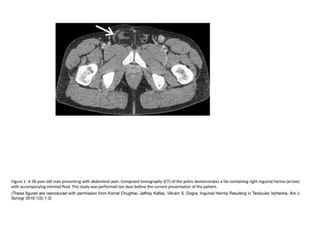 Figure 1: A 58-year-old man presenting with abdominal pain