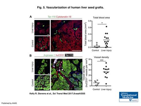 Fig. 5. Vascularization of human liver seed grafts.