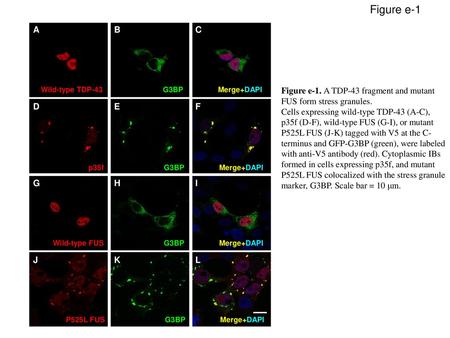 Figure e-1 A B C Wild-type TDP-43 G3BP Merge+DAPI