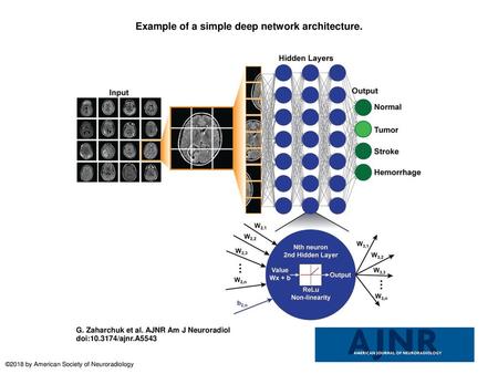 Example of a simple deep network architecture.