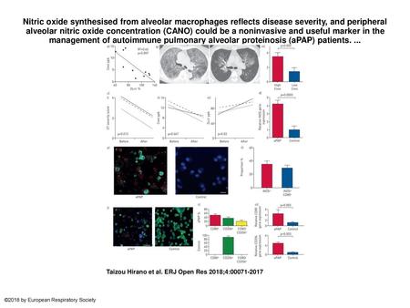 Nitric oxide synthesised from alveolar macrophages reflects disease severity, and peripheral alveolar nitric oxide concentration (CANO) could be a noninvasive.