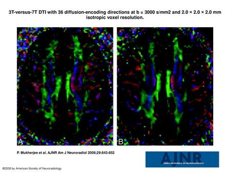 3T-versus-7T DTI with 36 diffusion-encoding directions at b = 3000 s/mm2 and 2.0 × 2.0 × 2.0 mm isotropic voxel resolution. 3T-versus-7T DTI with 36 diffusion-encoding.