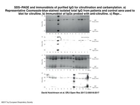 SDS–PAGE and immunoblots of purified IgG for citrullination and carbamylation. a) Representative Coomassie-blue-stained isolated total IgG from patients.