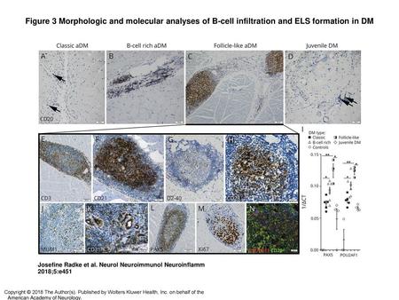 Figure 3 Morphologic and molecular analyses of B-cell infiltration and ELS formation in DM Morphologic and molecular analyses of B-cell infiltration and.