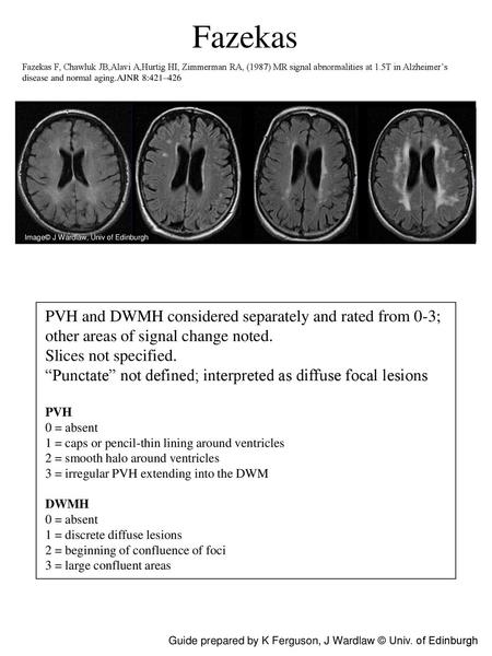 Fazekas PVH and DWMH considered separately and rated from 0-3;