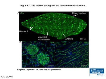 Fig. 1. CD31 is present throughout the human renal vasculature.