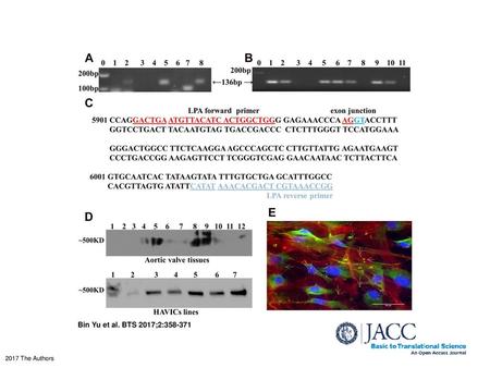 LPA mRNA and Protein Expression Were Detected in Primarily Cultured HAVICs and Aortic Valve Tissues (A) RT-PCR detection of LPA mRNA expression in primarily.