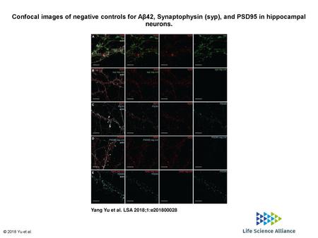 Confocal images of negative controls for Aβ42, Synaptophysin (syp), and PSD95 in hippocampal neurons. Confocal images of negative controls for Aβ42, Synaptophysin.