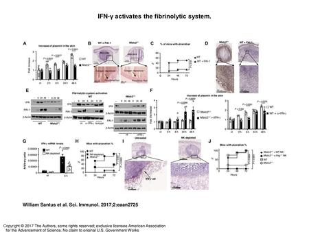 IFN-γ activates the fibrinolytic system.