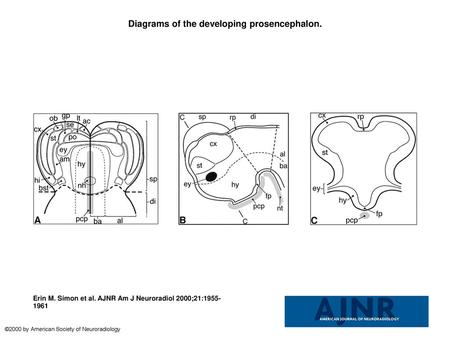 Diagrams of the developing prosencephalon.