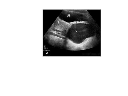 Figure 1: A 27-year-old woman with a history of urinary incontinence