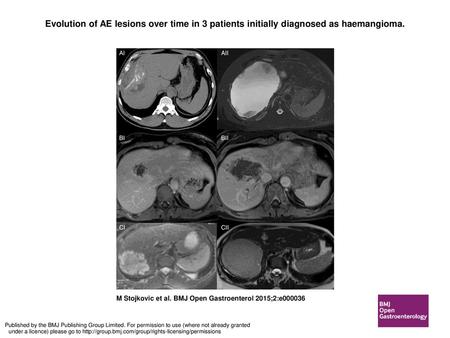 Evolution of AE lesions over time in 3 patients initially diagnosed as haemangioma. Evolution of AE lesions over time in 3 patients initially diagnosed.