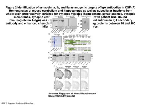 Figure 2 Identification of synapsin Ia, Ib, and IIa as antigenic targets of IgA antibodies in CSF (A) Homogenates of mouse cerebellum and hippocampus as.