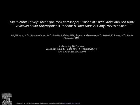 The “Double-Pulley” Technique for Arthroscopic Fixation of Partial Articular-Side Bony Avulsion of the Supraspinatus Tendon: A Rare Case of Bony PASTA.