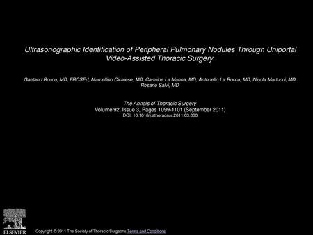 Ultrasonographic Identification of Peripheral Pulmonary Nodules Through Uniportal Video-Assisted Thoracic Surgery  Gaetano Rocco, MD, FRCSEd, Marcellino.