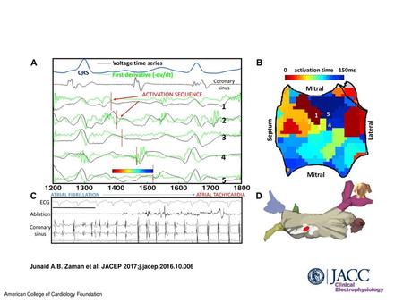 Junaid A.B. Zaman et al. JACEP 2017;j.jacep