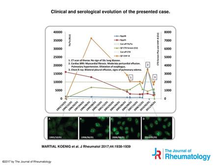 Clinical and serological evolution of the presented case.