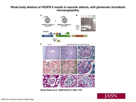 Whole body deletion of VEGFR-2 results in vascular defects, with glomerular thrombotic microangiopathy. Whole body deletion of VEGFR-2 results in vascular.