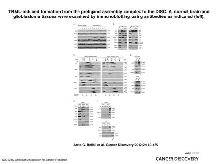 TRAIL-induced formation from the preligand assembly complex to the DISC. A, normal brain and glioblastoma tissues were examined by immunoblotting using.