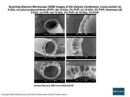 Scanning Electron Microscope (SEM) images of the dialysis membranes: cross-section (a) 6 kDa, no polyvinylpyrrolidone (PVP); (b) 12 kDa, 2% PVP; (c) 16 kDa,