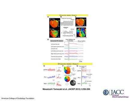 Masatoshi Yamazaki et al. JACEP 2015;1: