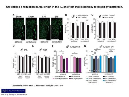 SNI causes a reduction in AIS length in the IL, an effect that is partially reversed by metformin. SNI causes a reduction in AIS length in the IL, an effect.