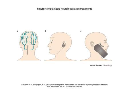 Figure 4 Implantable neuromodulation treatments