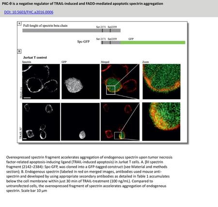 PKC-θ is a negative regulator of TRAIL-induced and FADD-mediated apoptotic spectrin aggregation DOI: 10.5603/FHC.a2016.0006 Overexpressed spectrin fragment.