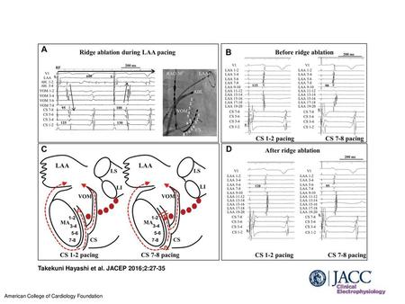 Takekuni Hayashi et al. JACEP 2016;2:27-35