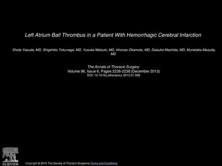 Left Atrium Ball Thrombus in a Patient With Hemorrhagic Cerebral Infarction  Shota Yasuda, MD, Shigehiko Tokunaga, MD, Yusuke Matsuki, MD, Hironao Okamoto,