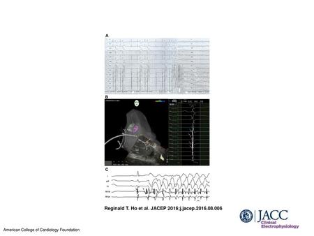 Reginald T. Ho et al. JACEP 2016;j.jacep