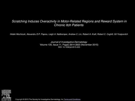 Scratching Induces Overactivity in Motor-Related Regions and Reward System in Chronic Itch Patients  Hideki Mochizuki, Alexandru D.P. Papoiu, Leigh A.