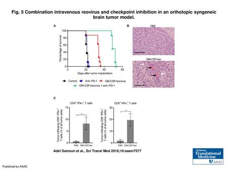 Fig. 5 Combination intravenous reovirus and checkpoint inhibition in an orthotopic syngeneic brain tumor model. Combination intravenous reovirus and checkpoint.