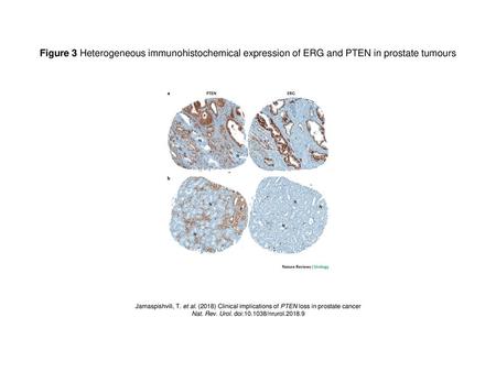 Nat. Rev. Urol. doi: /nrurol