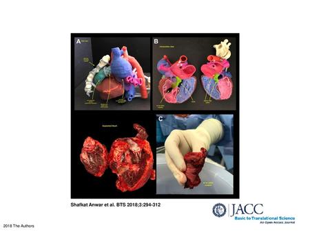 Shafkat Anwar et al. BTS 2018;3: