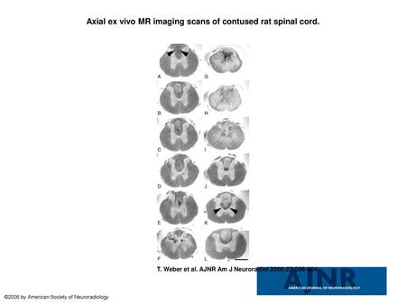 Axial ex vivo MR imaging scans of contused rat spinal cord.