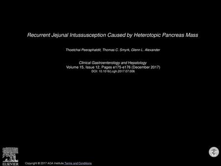 Recurrent Jejunal Intussusception Caused by Heterotopic Pancreas Mass