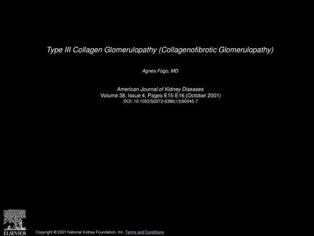 Type III Collagen Glomerulopathy (Collagenofibrotic Glomerulopathy)