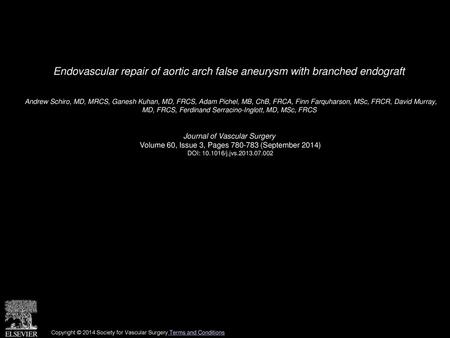 Endovascular repair of aortic arch false aneurysm with branched endograft  Andrew Schiro, MD, MRCS, Ganesh Kuhan, MD, FRCS, Adam Pichel, MB, ChB, FRCA,