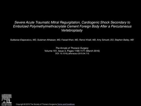 Severe Acute Traumatic Mitral Regurgitation, Cardiogenic Shock Secondary to Embolized Polymethylmethracrylate Cement Foreign Body After a Percutaneous.