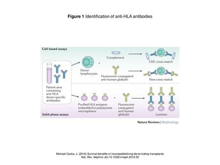 Figure 1 Identification of anti-HLA antibodies