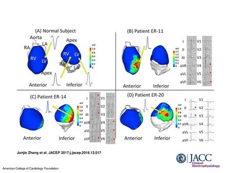 Junjie Zhang et al. JACEP 2017;j.jacep