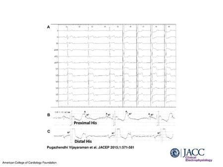 Pugazhendhi Vijayaraman et al. JACEP 2015;1: